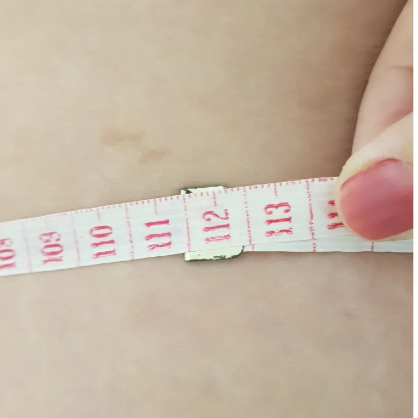 Medição do culote com fita métrica depois das sessões de lipoenzimática